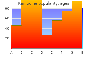 ranitidine 150 mg cheap without prescription