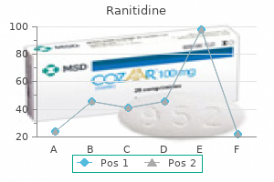 300 mg ranitidine generic with mastercard