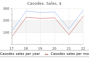 casodex 50 mg amex