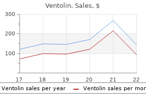 ventolin 100 mcg with amex