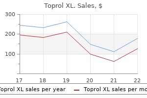 buy toprol xl 25 mg on line