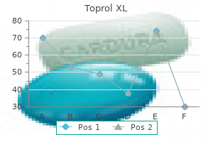 generic 50 mg toprol xl fast delivery