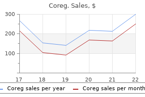 order 12.5 mg coreg free shipping