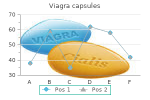 100mg viagra capsules purchase with visa